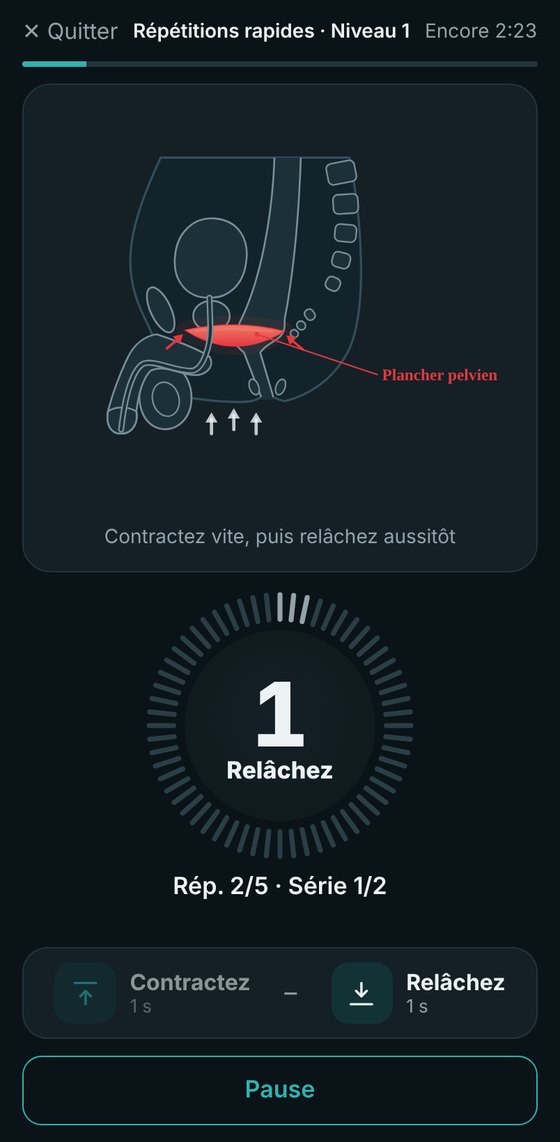 L’entraînement du périnée dans l’application