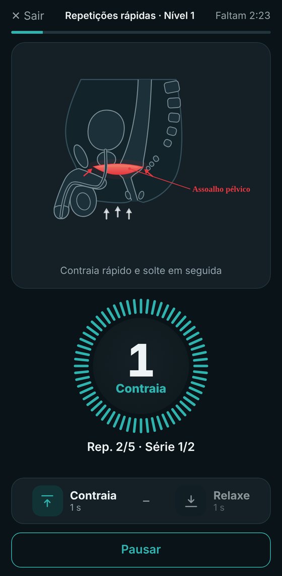 Treino do assoalho pélvico no app
